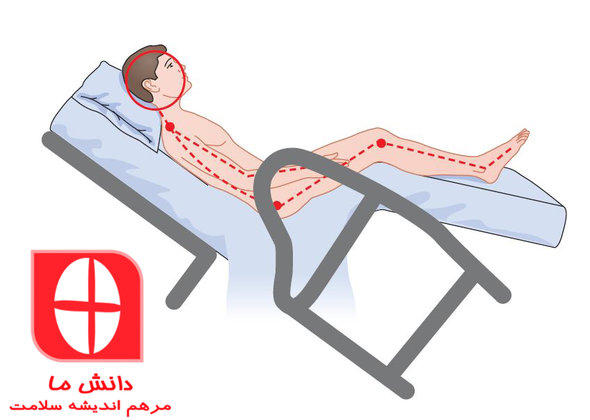 پیشگیری از زخم بستر در برای بیماران بستری در تخت