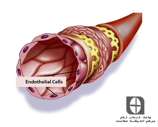 سلول های اندوتلیال فعال شده