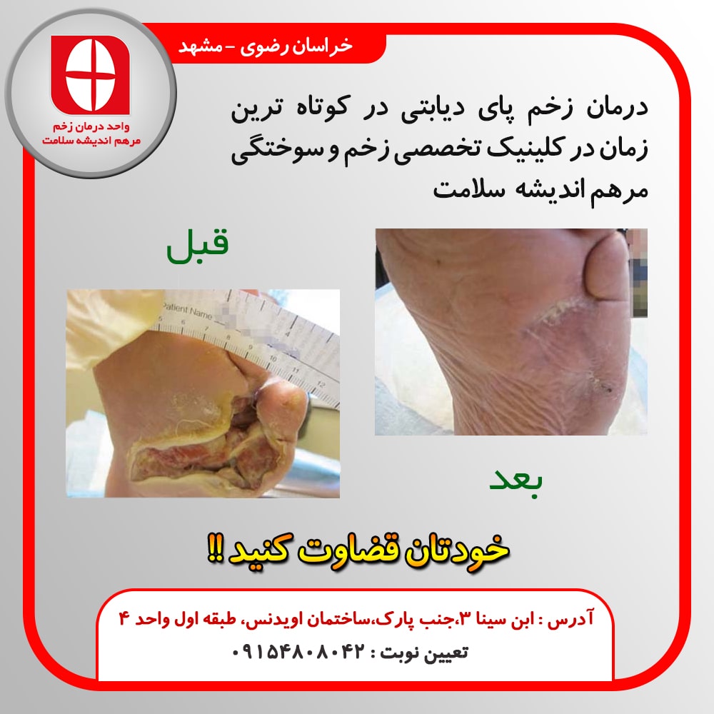 کلینیک تخصصی درمان زخم در مشهد