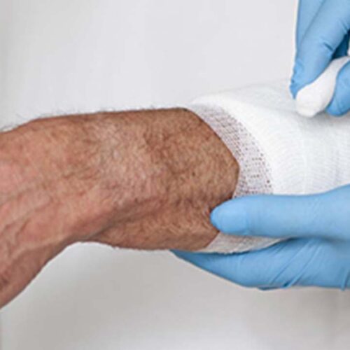 اصول اولیه مدیریت زخم: راهنمای جامع زخم کلینیک درمان زخم مشهد