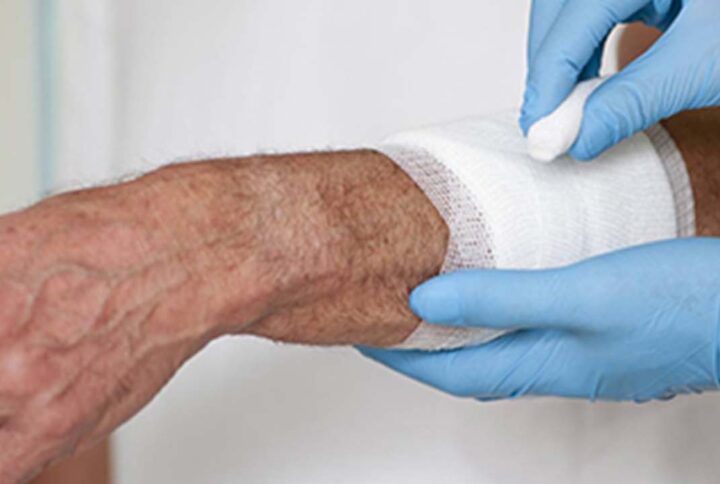 اصول اولیه مدیریت زخم: راهنمای جامع زخم کلینیک درمان زخم مشهد